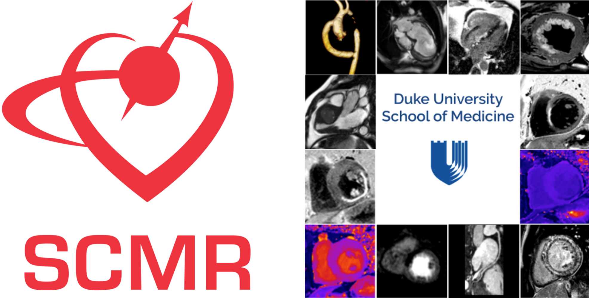 Duke Cardiovascular MR Practicum and CMR Board Review Course Photo