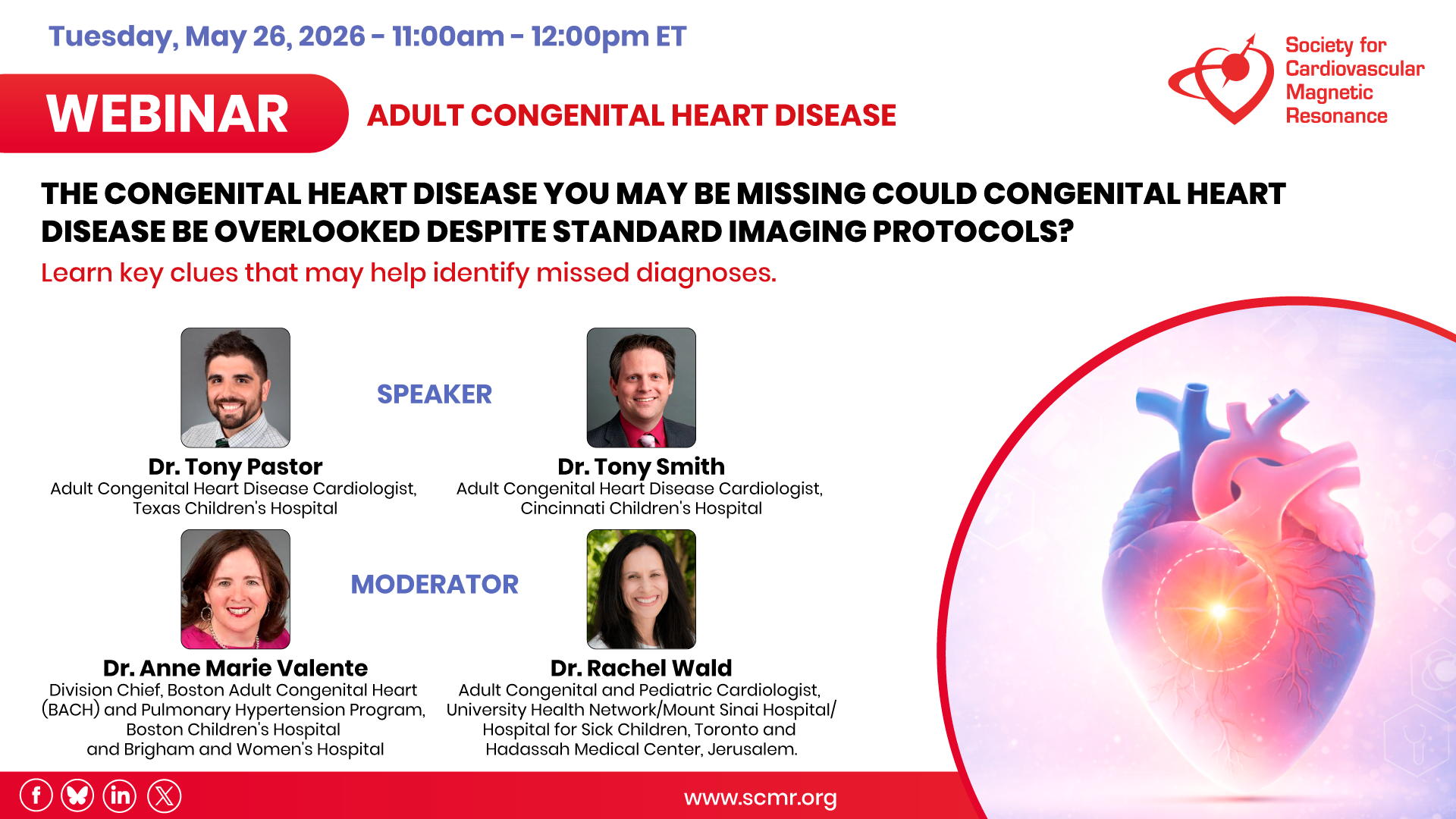 The Congenital Heart Disease You May Be Missing… Could congenital heart disease be overlooked despite standard imaging protocols? Learn key clues that may help identify missed diagnoses. Photo