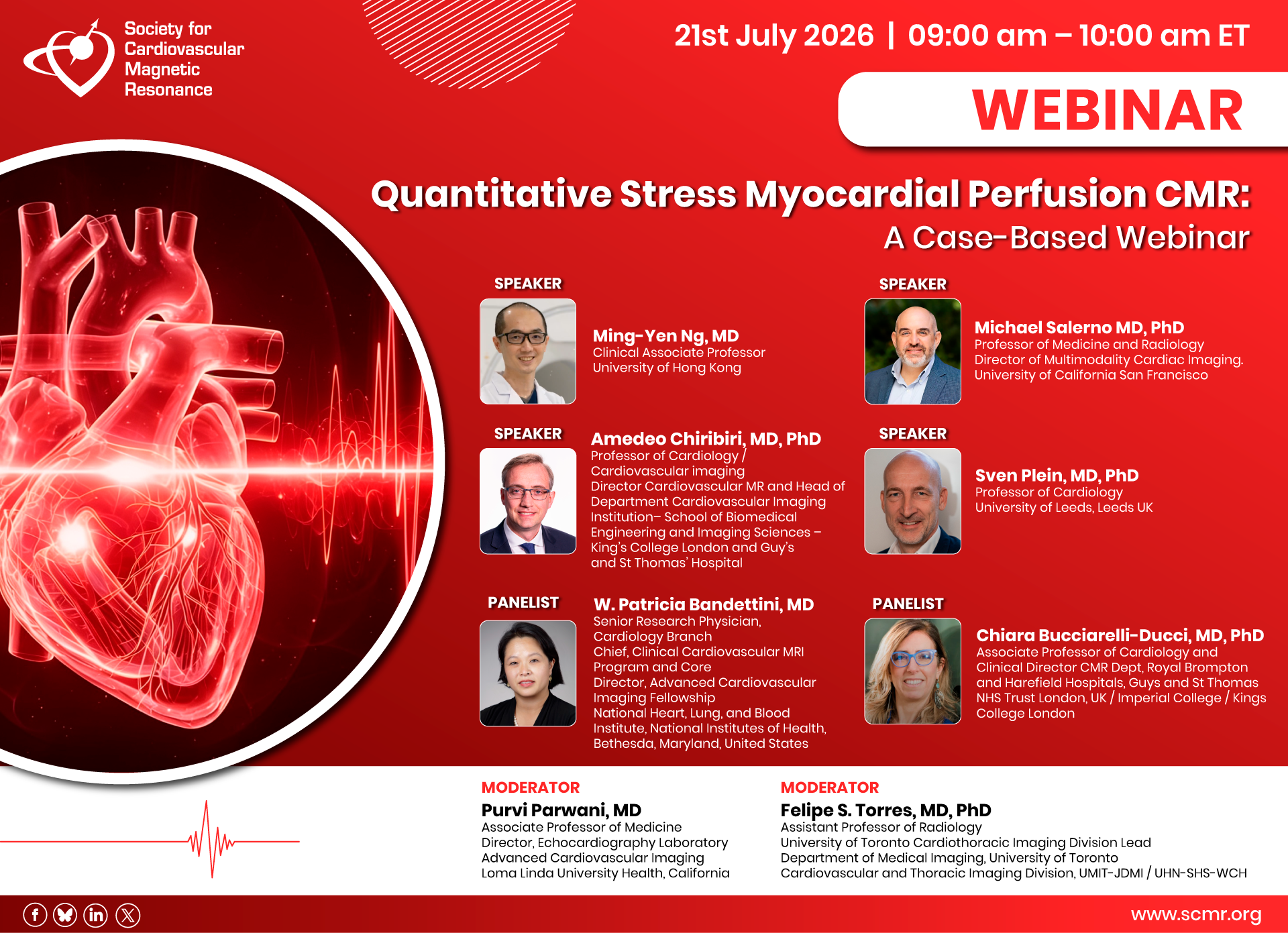 Quantitative Stress Myocardial Perfusion CMR: A Case-Based Webinar Photo