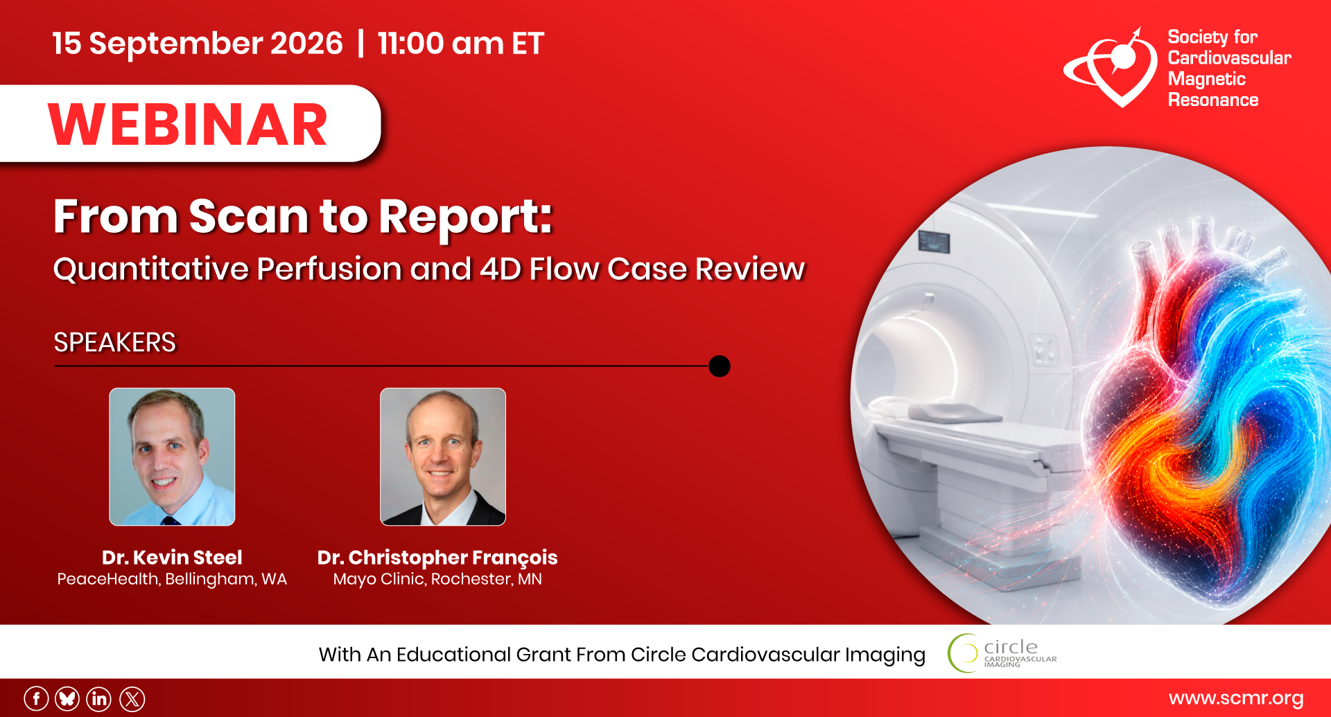 From Scan to Report: 4D Flow and Quantitative Perfusion in cvi42 6.5 Photo